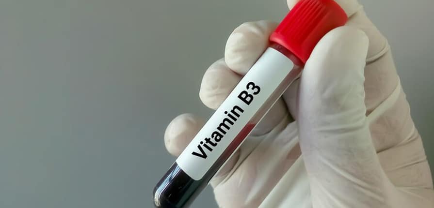 Витамин B3 в бодибилдинге